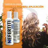 Shampoo Sin Sal Para Control De Caspa Nefertiti 300ml